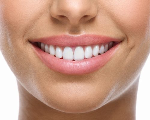 Airflow® Tooth Polishing - Platinum Dental Care